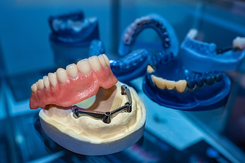 Dentistry. Models of removable dentures. Prosthetics of the dental cavity. Dentures on the jaw. The manufacture of dental prostheses. Prosthetist. Dental technician.