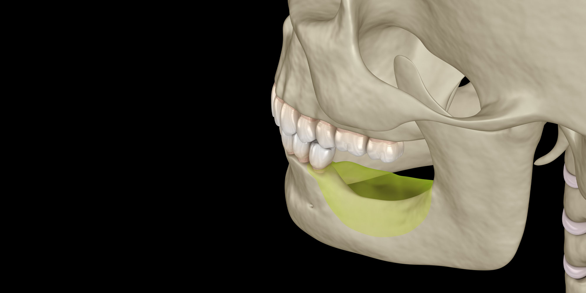 image graphic of bone graft