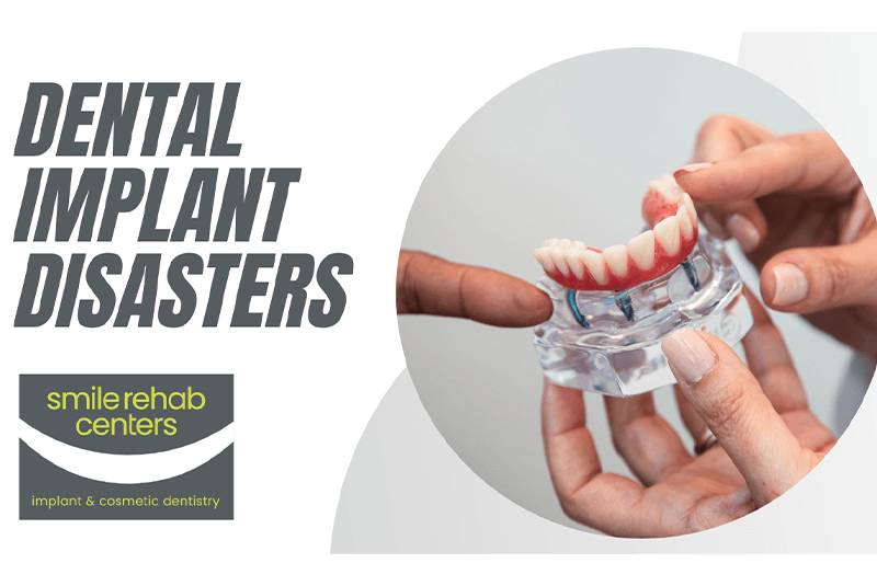 Dental Implant Disaster thumbnail
