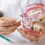 dentist implantologist showing dental bridge implant technology on human tooth jaw model